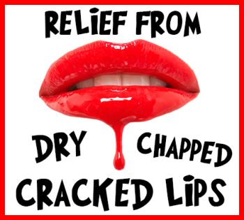 Torrance dentist, Dr. Bradley Miller at Miller Family Dental, tells you how to relieve your dry, chapped, and cracked lips!