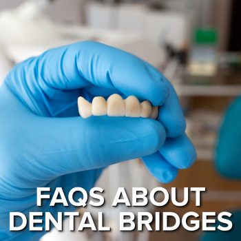 Torrance dentist, Dr. Bradley Miller at Miller Family Dental, answers common questions about dental bridges, providing essential information for prospective patients.