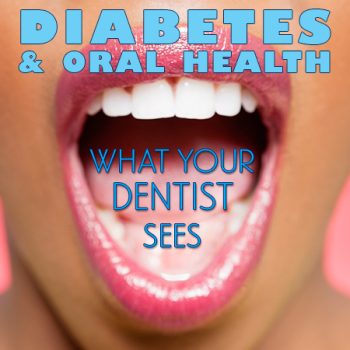 Torrance dentist, Dr. Bradley Miller at Miller Family Dental, discusses the side effects of diabetes and how it affects your oral health.