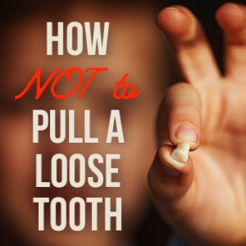 Torrance dentist, Dr. Bradley Miller at Miller Family Dental, tells parents the do’s and don’ts of pulling your child’s loose baby teeth for the safest and most painless experience.