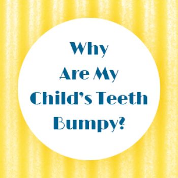 Torrance dentist, Dr. Bradley Miller at Miller Family Dental, tells parents about bumpy tooth ridges called mamelons and why they’re no cause for concern.