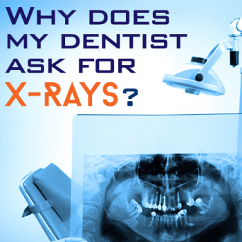 Torrance dentist, Dr. Bradley Miller at Miller Family Dental, discusses the importance of dental X-rays for accurate diagnosis and treatment planning.